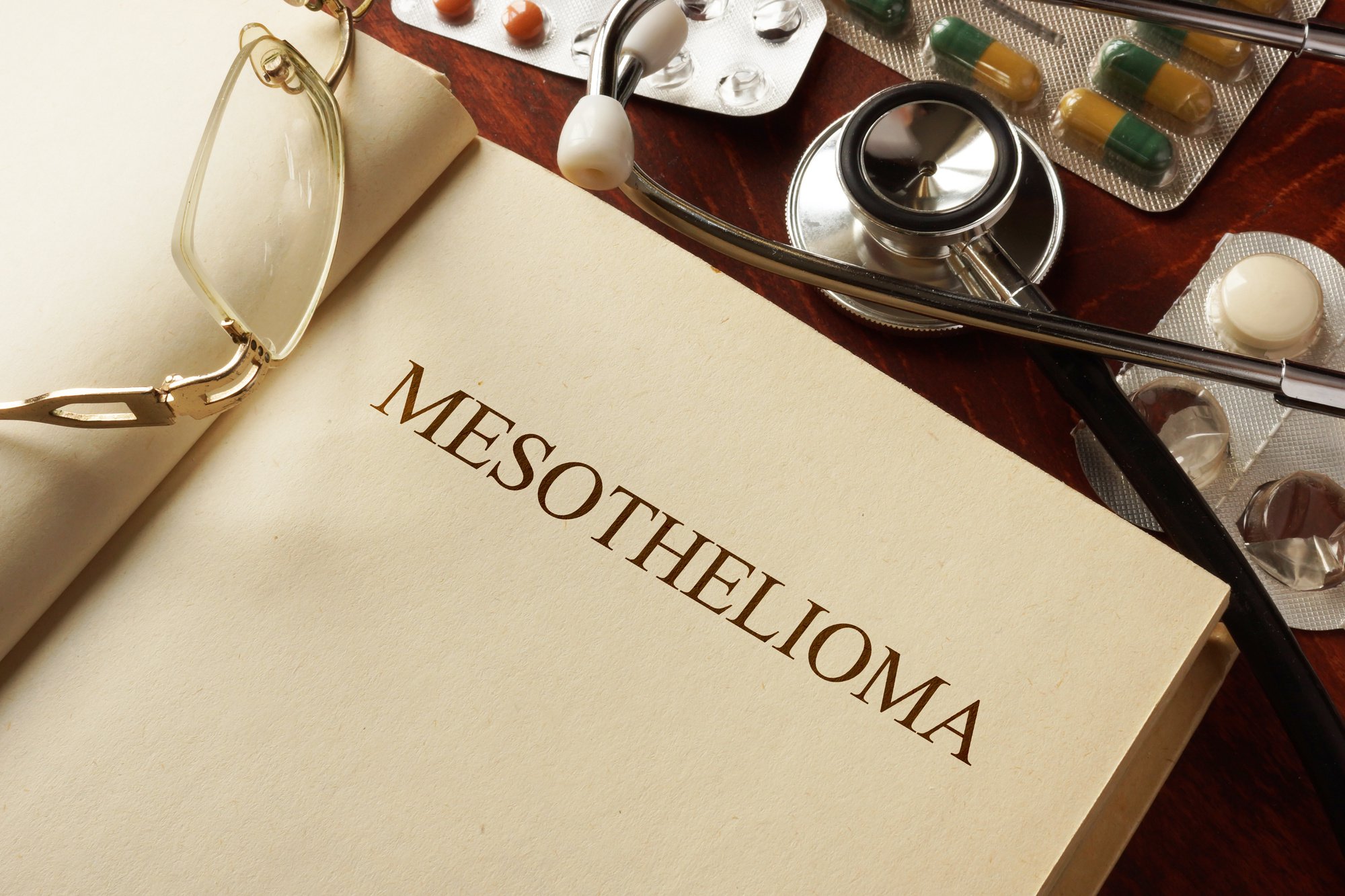What are the top-notch benefits of hiring a mesothelioma lawyer?
